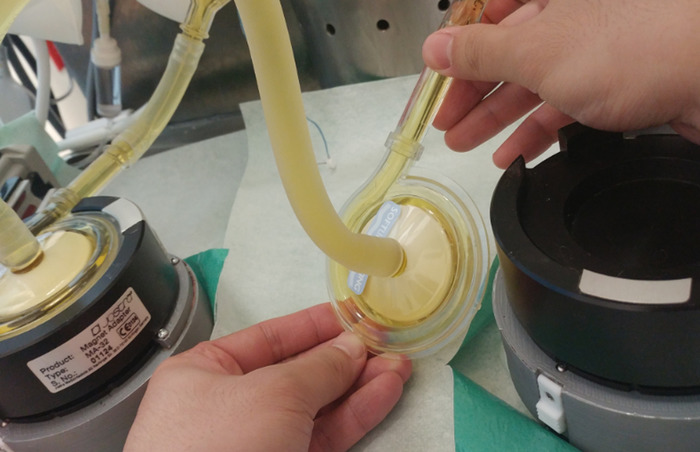 Cardiopulmonary bypass setup, depicting tube connection process for heart-lung machine operation.
