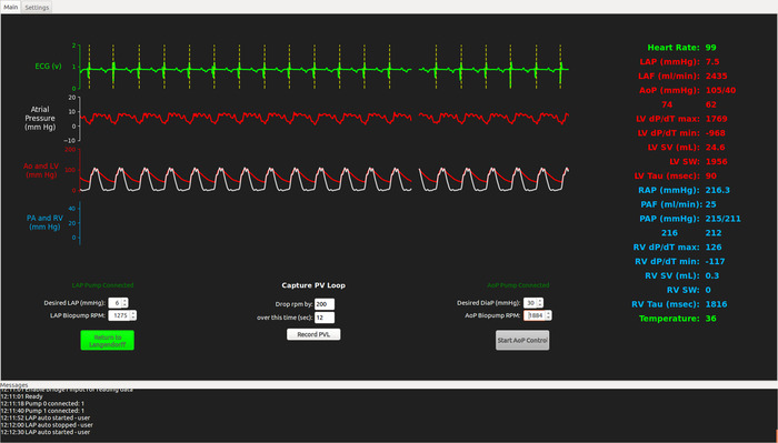 Cardiac function analysis; ECG, atrial pressure graph; heart and respiratory parameters display.