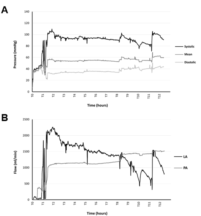 Pressure-flow analysis; graphs A: Systolic/diastolic pressure, B: LA/PA flow over 12 hours.