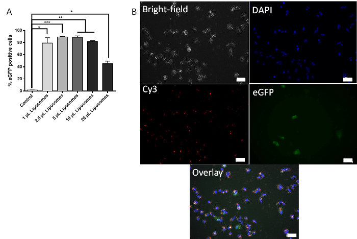 figure-results-4 Liposome transfection results; bar graph and fluorescence microscopy panel; GFP expression; cell study.