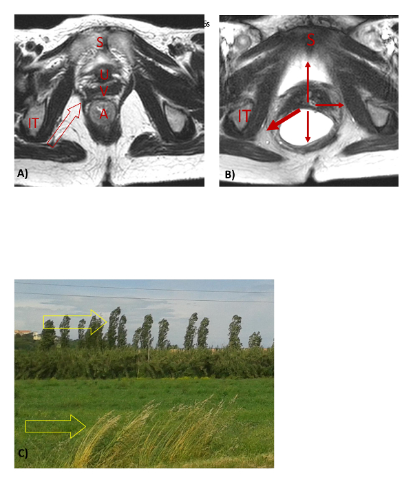 figure-discussion-1 盆腔MRI与流体动力学比较;解剖结构标注;景观中的风向。