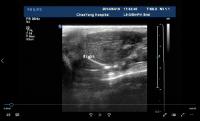 Obraz ultrasonograficzny; obrazowanie medyczne; na żywo analiza diagnostyczna; skan anatomiczny; szczegóły o wysokiej rozdzielczości.