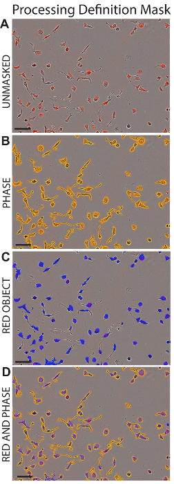 figure-results-1 Cell analysis diagram showing processing masks: unmasked, phase, red object, and red-phase overlay.