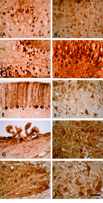 Brain tissue sections in microscopy images; histological staining reveals cellular structures comparison.