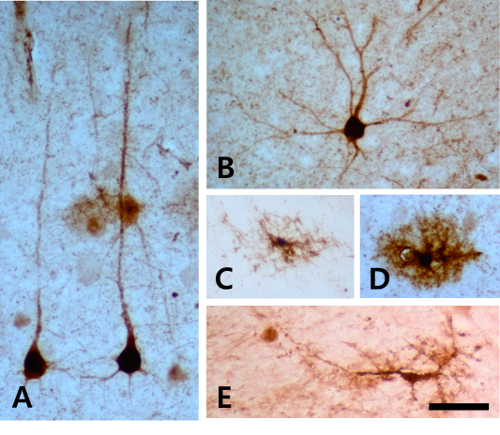 Neurons stained microscopy image; neuronal structure visualization for neuroscience research.