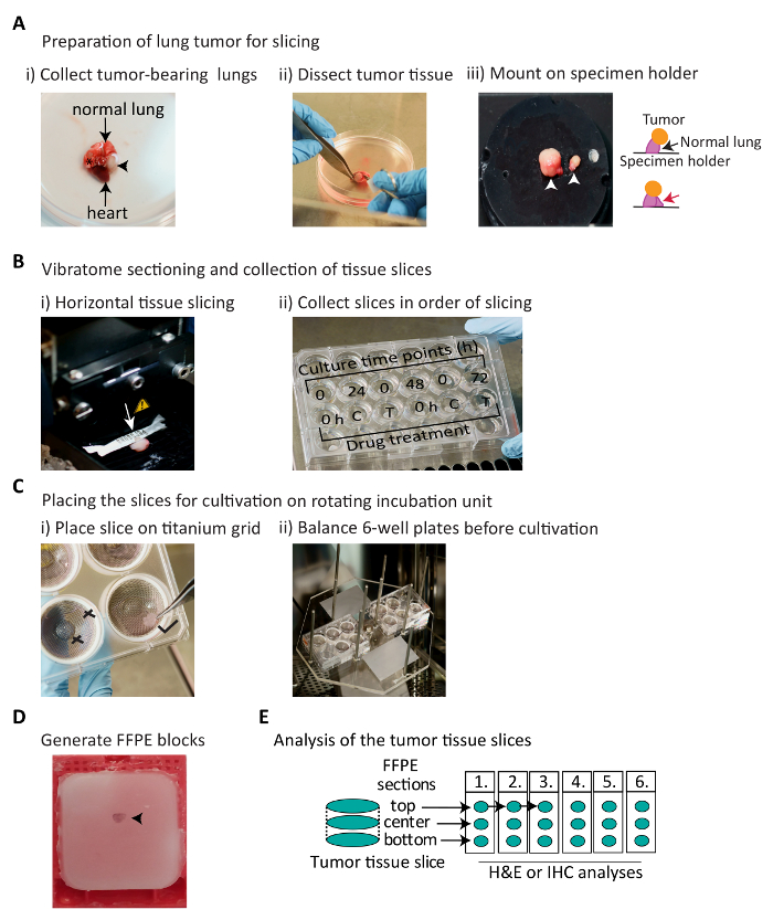 figure-results-1 Lung tumor preparation and analysis: dissection, vibratome sectioning, incubation, FFPE blocks.