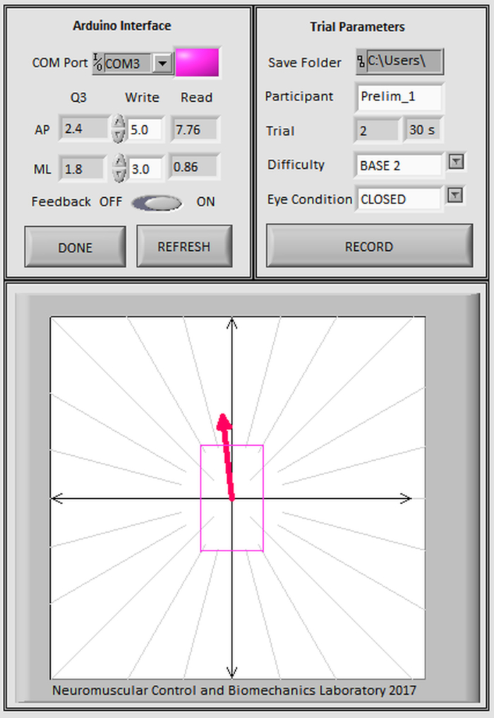 Neuromuscular control diagram; Arduino interface setup; biomechanics trial parameters; feedback on.