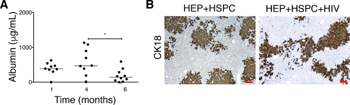Albumin levels over time graph and CK18 stained cell images for hepatic research analysis.