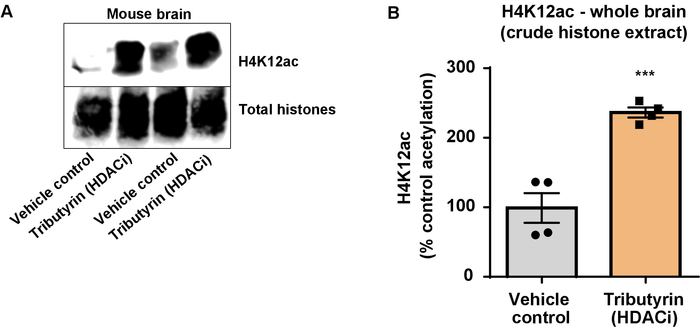 figure-results-6 Mouse brain histone acetylation; Western blot and bar chart; H4K12ac analysis with HDAC inhibitor.