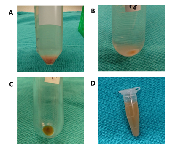 figure-results-4 Centrifugation results, test tubes with pellets, sample separation process, laboratory experiment.
