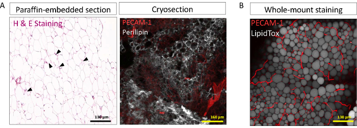 Paraffin and cryosection tissue staining, PECAM-1, Perilipin, LipidTox, microscopy analysis.