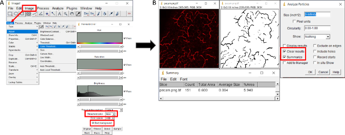 Image thresholding process; software interface diagram; particle analysis setup for image quantification.
