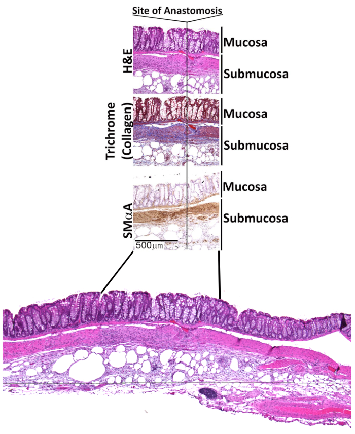 Histology slides showing intestinal anastomosis site, stained with H&E, trichrome, SMA; tissue layers.