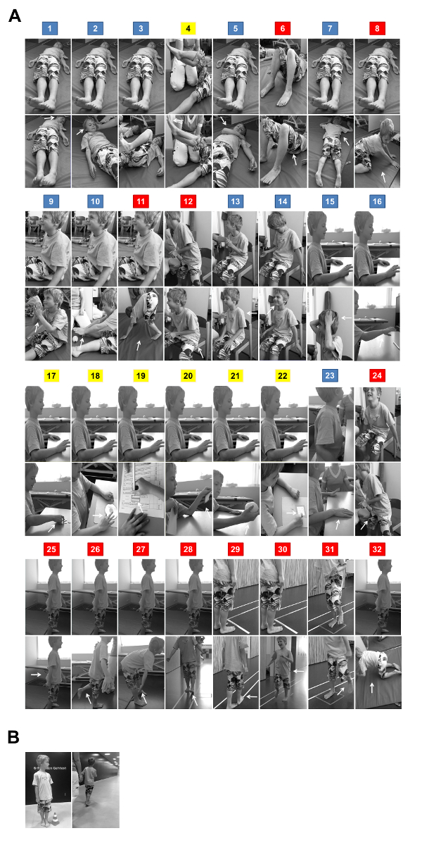 Physical therapy exercises for children; sequential photos detailing positions and movements, therapy sessions.