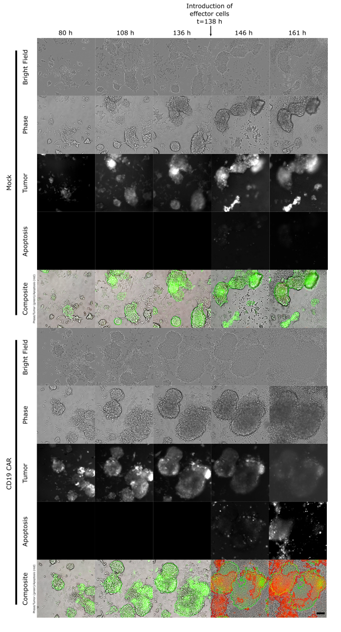 figure-results-2 Cell apoptosis in time-lapse microscopy; tumor cell interactions; effector cell introduction; experiment.