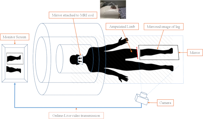 MRI setup with mirror therapy diagram; amputated limb, mirror image, live video transmission process.