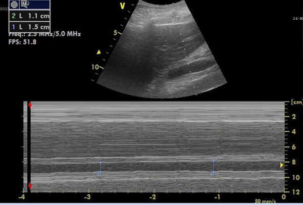 figure-results-6 Ultrasound Doppler diagram; velocity measurement; blood flow analysis; medical imaging technique.