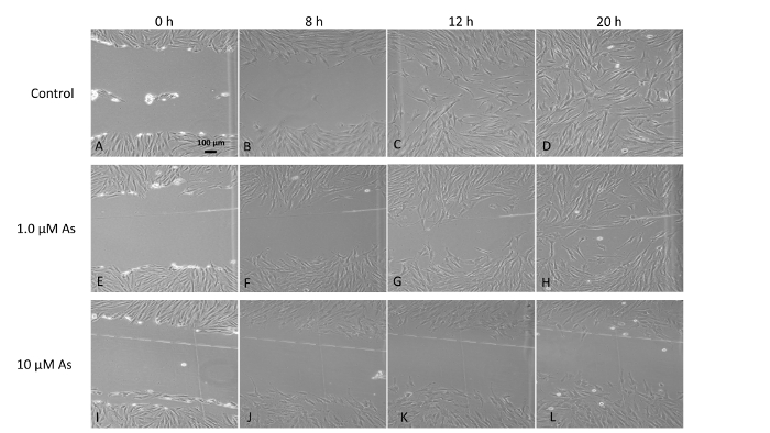 Cell growth under arsenic exposure; microscopy results; control, 1.0 µM, and 10 µM As over 20 hours.