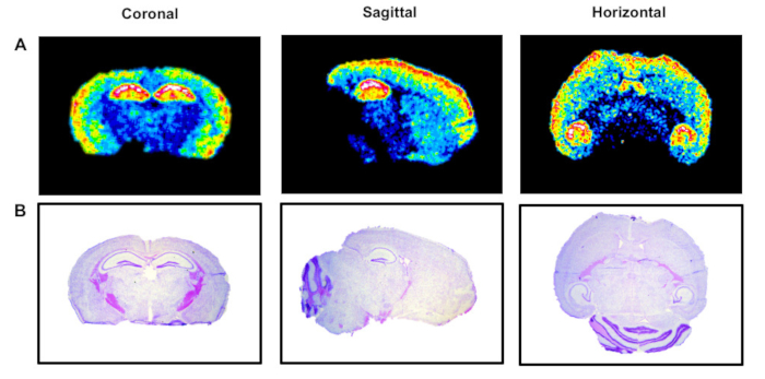 figure-results-3 Brain imaging cross-sections: coronal, sagittal, horizontal; heatmap and histology comparison.