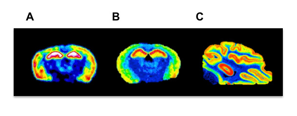 figure-results-4 PET scan brain images comparison; sections A-C show varied activity levels; neuroimaging analysis.