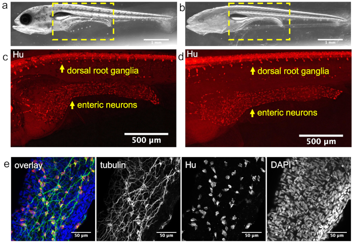 Zebrafish neuron imaging; fluorescence microscopy, dorsal root ganglia, enteric neurons, neural study.