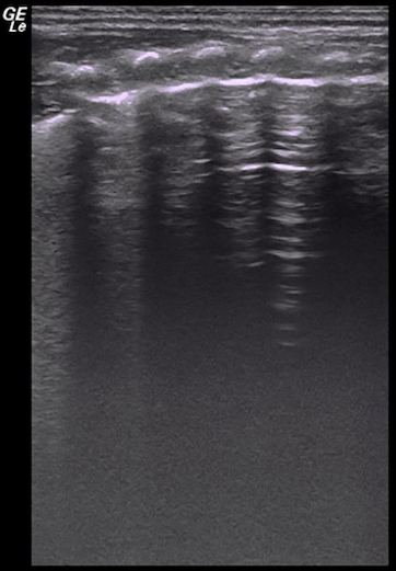 Ultraschallbildgebung, medizinische Diagnosegeräte, Visualisierung von Gewebestrukturen, Graustufenbild.
