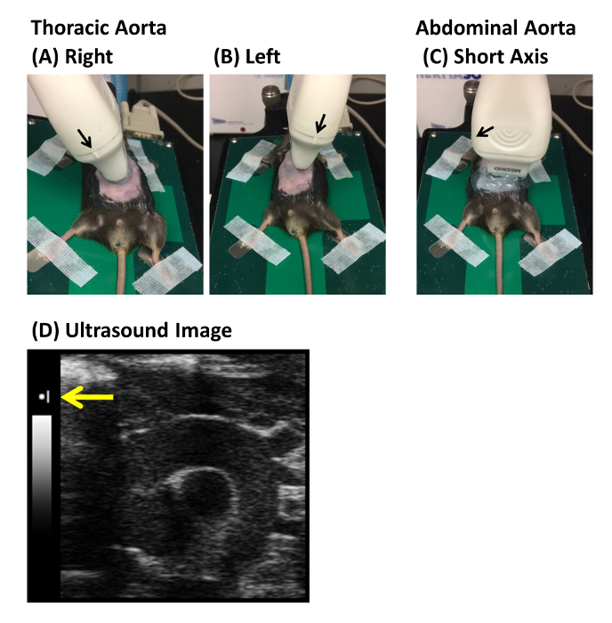 Ultrasound scanning setup on rodent aorta, highlighting thoracic and abdominal views; ultrasound result.