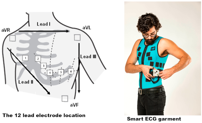 ECG lead placement diagram and smart ECG garment, illustrating wearable cardiac monitoring.