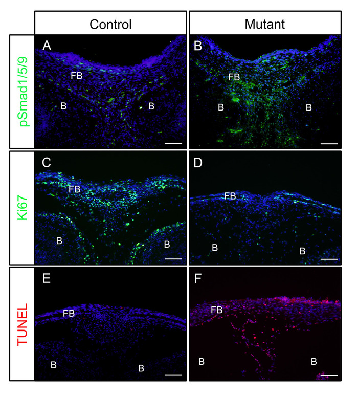 figure-results-1 Fluorescence microscopy diagram; pSmad1/5/9, Ki67, TUNEL assays; control vs. mutant fibroblasts.
