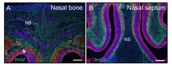figure-results-2 Nasal bone and septum microscopy image showing cellular structure, labeled with mG/mT/DAPI markers.