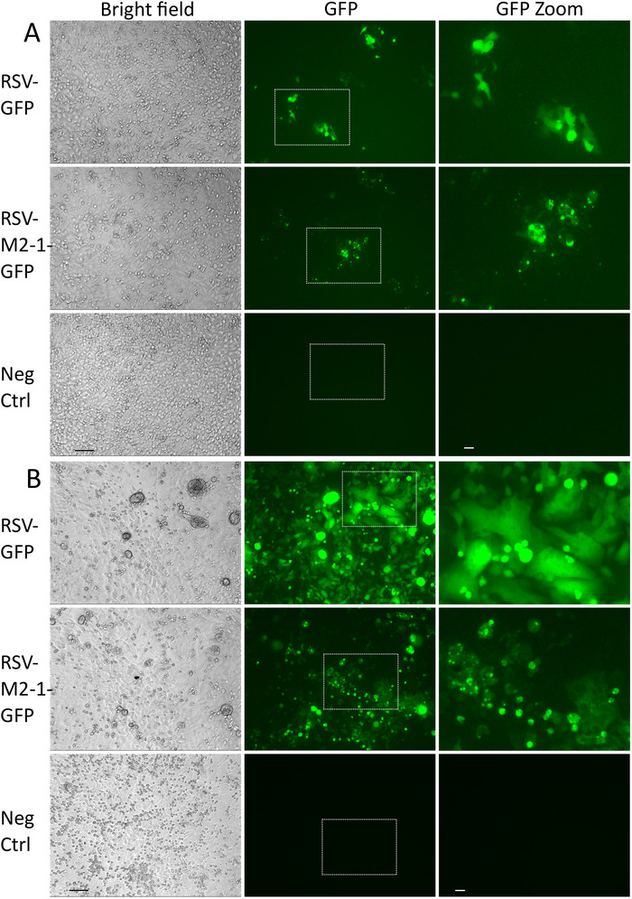 figure-results-2 Brightfield and GFP microscopy of RSV-infected cells, highlighting GFP expression and control.