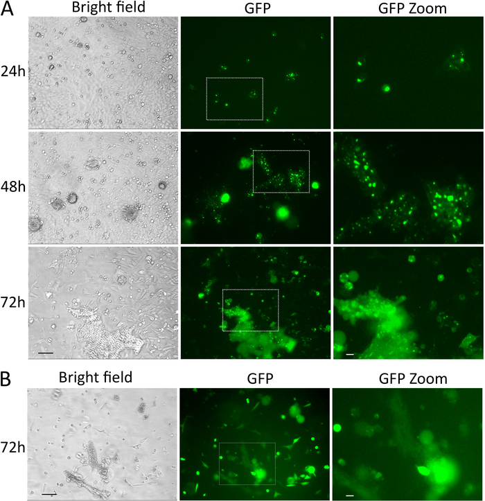 figure-results-3 Microscopy analysis of GFP expression over time; bright field and fluorescence images.
