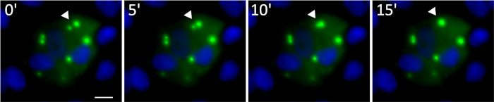 figure-results-8 Fluorescence microscopy, time-lapse, nuclear localization, green fluorescence, cellular imaging.