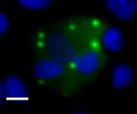 figure-results-10 Cell analysis with fluorescent microscopy; blue nuclei, green proteins, microscope image.