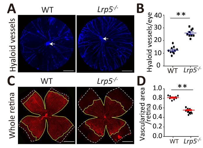 Hyaloid vessels, retina vasculature comparison in WT and Lrp5-/-; diagram and graph analysis.