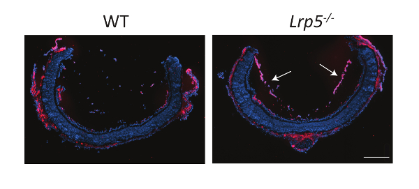 Histology comparison of WT vs. Lrp5-/-; arterial cross-sections; structural analysis.