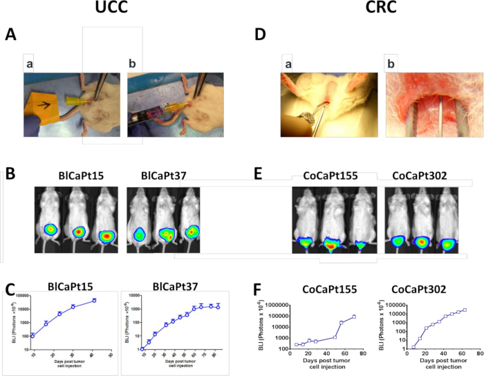Patient-derived Orthotopic Xenograft Models for Human Urothelial Cell ...