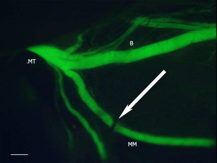 figure-results-1 Fluorescence microscopy of plant vasculature. Green fluorescent proteins highlight vein structures.
