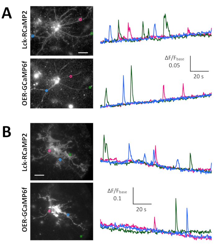 Calcium imaging in neurons with fluorescence intensity graphs; microscope images, data analysis.