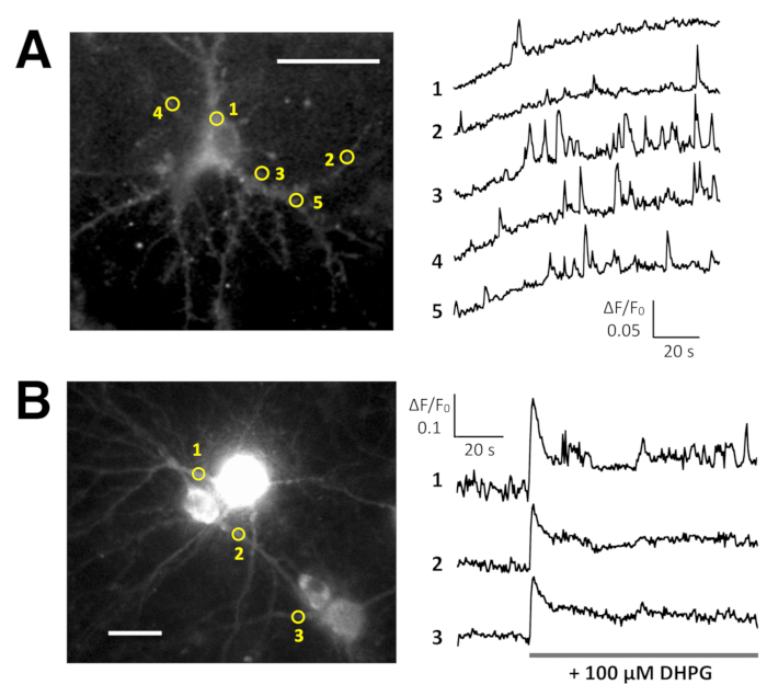 Neuron fluorescence microscopy with dendritic calcium signaling traces, data illustrating neural activity.