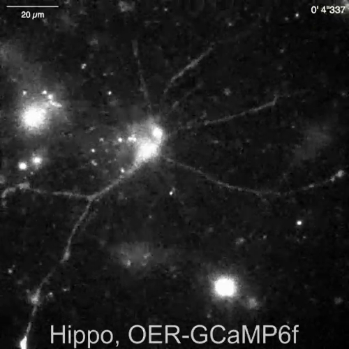 Microscope image of neuron activity using OER-GCaMP6f sensor with fluorescence visualization.