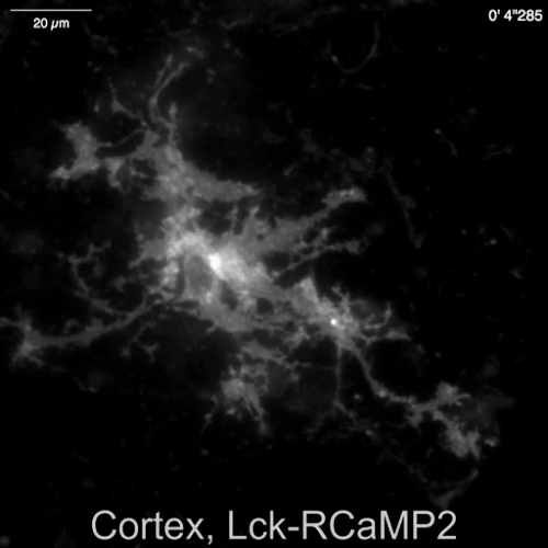 Cortical neuron fluorescence microscopy image showing Lck-RCaMP2 activity analysis.