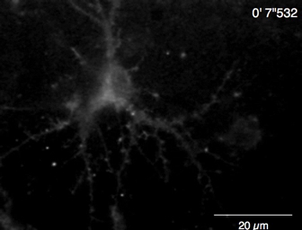 Neuron network microscopy image; dendritic structure visualization, scale bar 20 µm, fluorescence.
