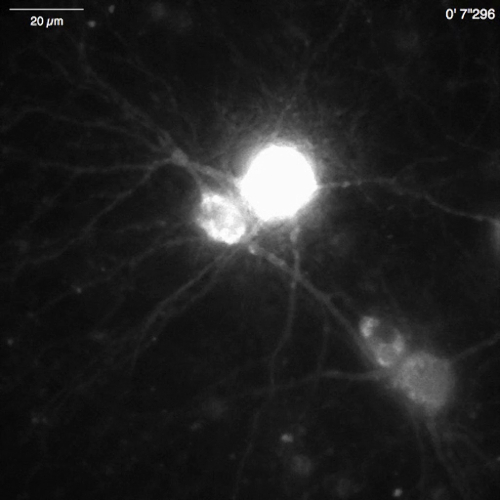 Neuronal cell fluorescence microscope image, cell body, and dendrites visible; neural imaging study.