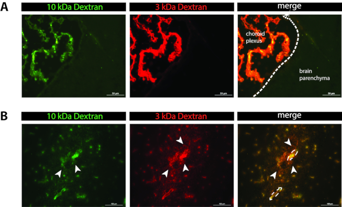 Fluorescence microscopy, dextran localization, brain sections, choroid plexus, parenchyma, merged images.