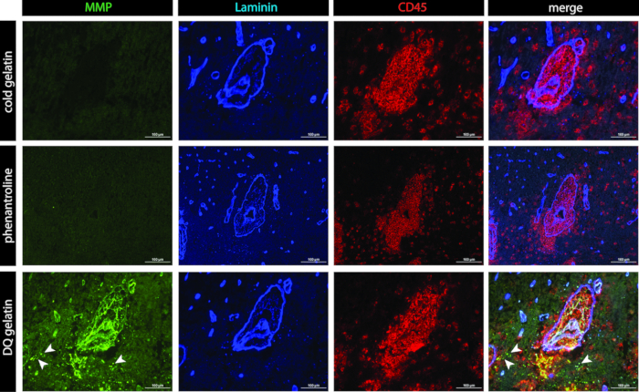 MMP, Laminin, CD45 immunofluorescence microscopy; enzyme activity analysis in gelatin matrix.