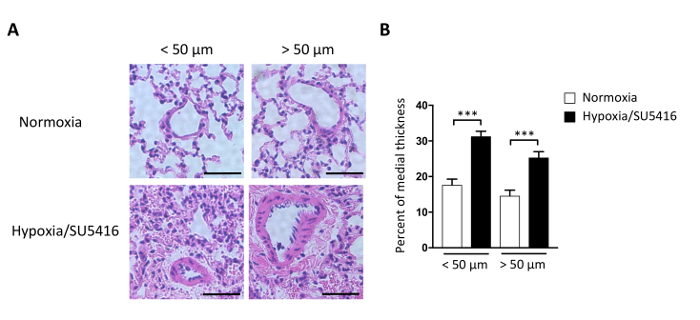figure-results-3 组织学切片,常氧组与低氧/SU5416组;柱状图显示中膜厚度百分比。