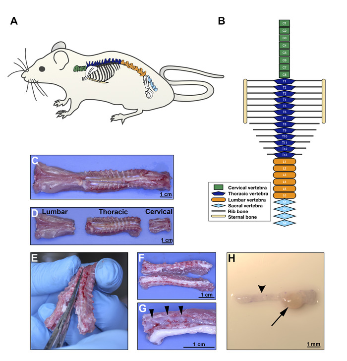figure-results-2 Mouse vertebrae study with diagrams and dissection images showing cervical, thoracic, lumbar sections.