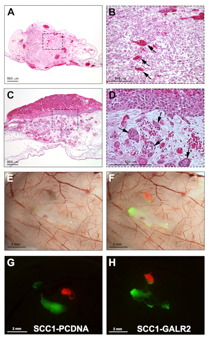 figure-results-5 Histological analysis, stained tissue slides, magnified views; tumor growth comparison, microscopy results.