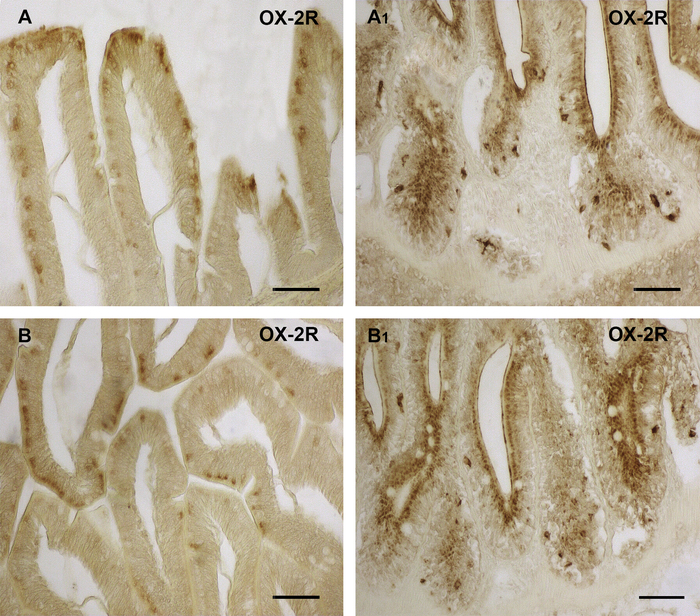 Histology: OX-2R staining in tissue samples, microscopy image, receptor analysis, cellular localization.